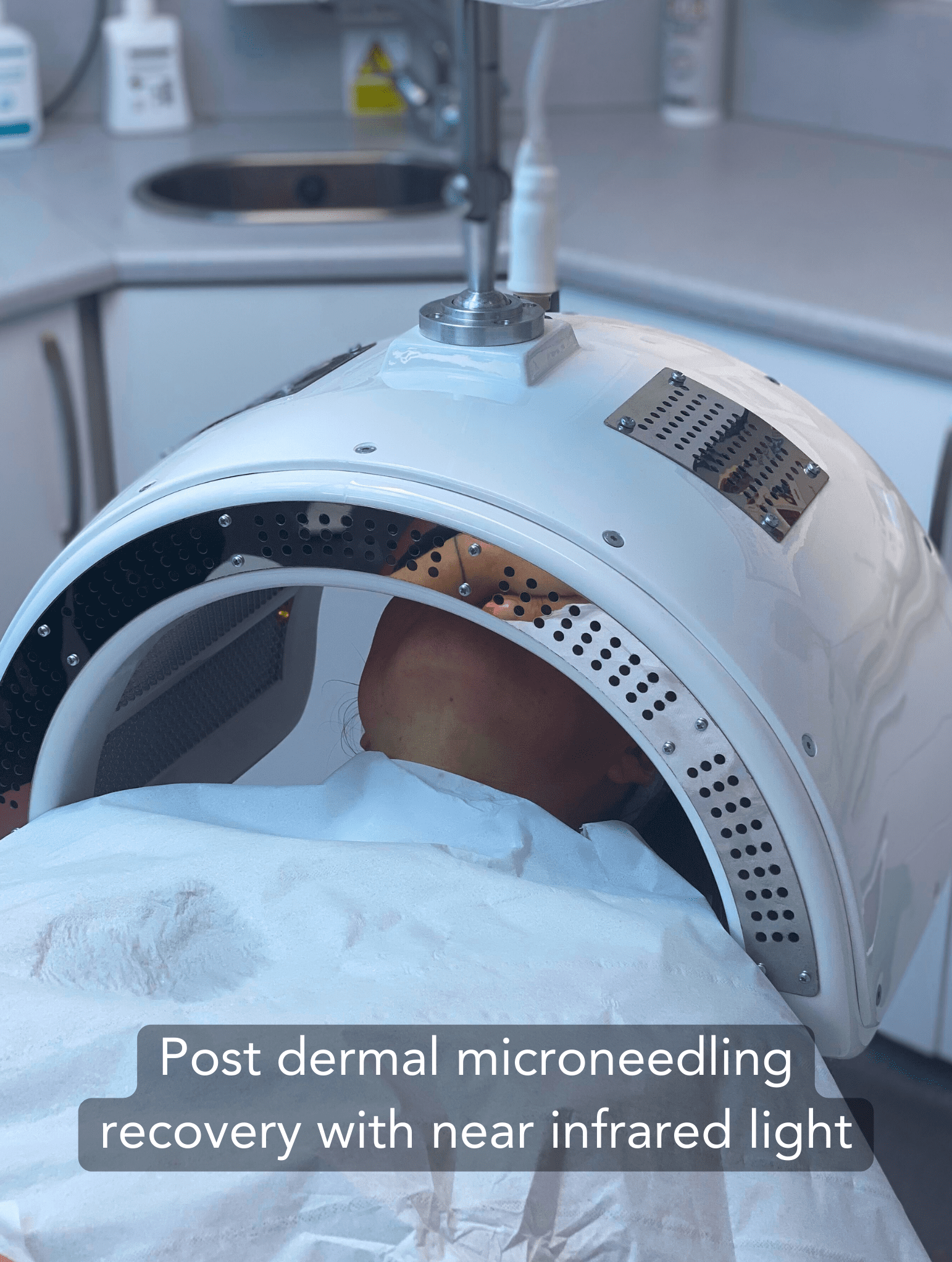 Dermalux post-microneedling recovery with near infrared