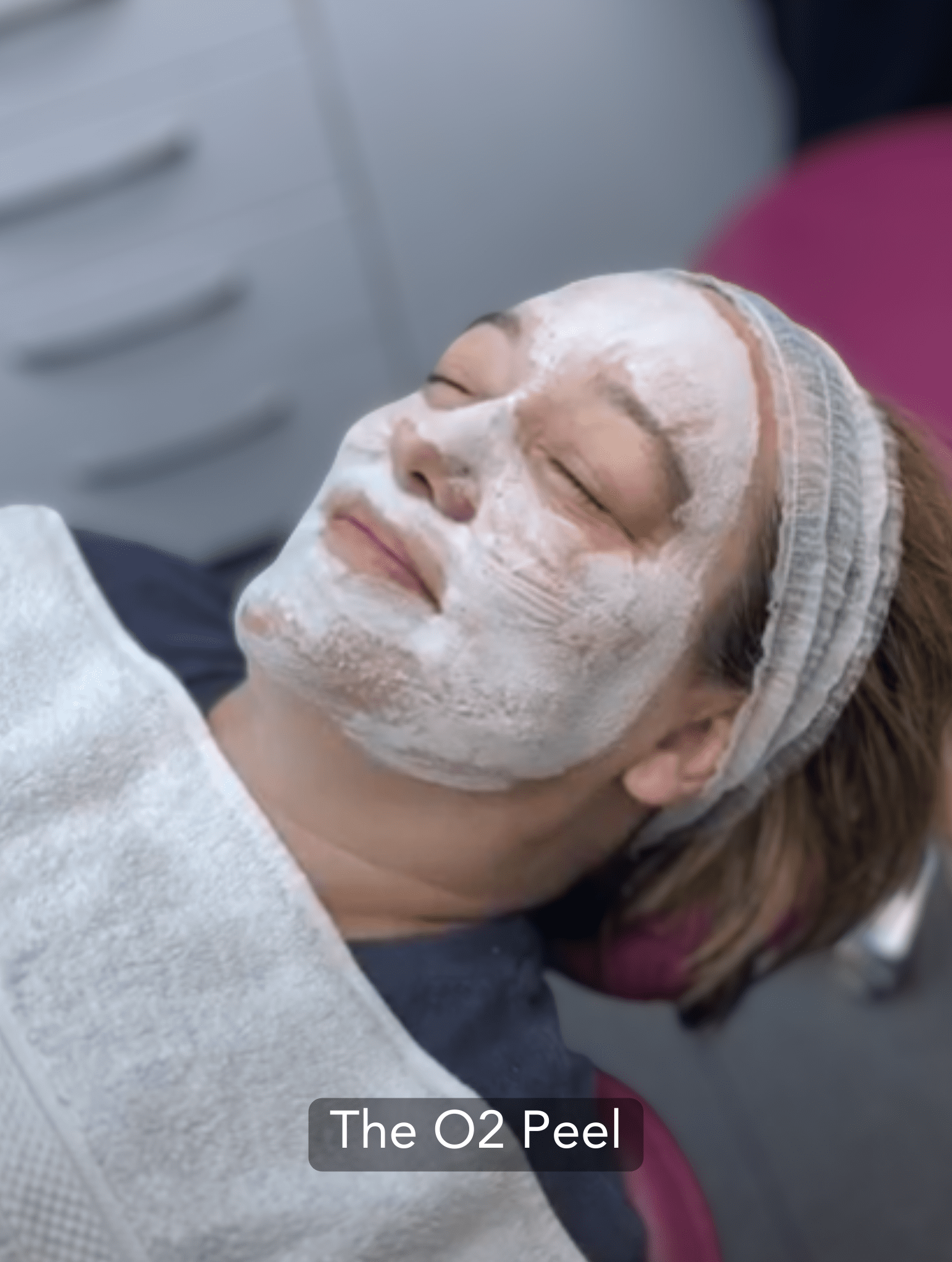 O2 peel treatment